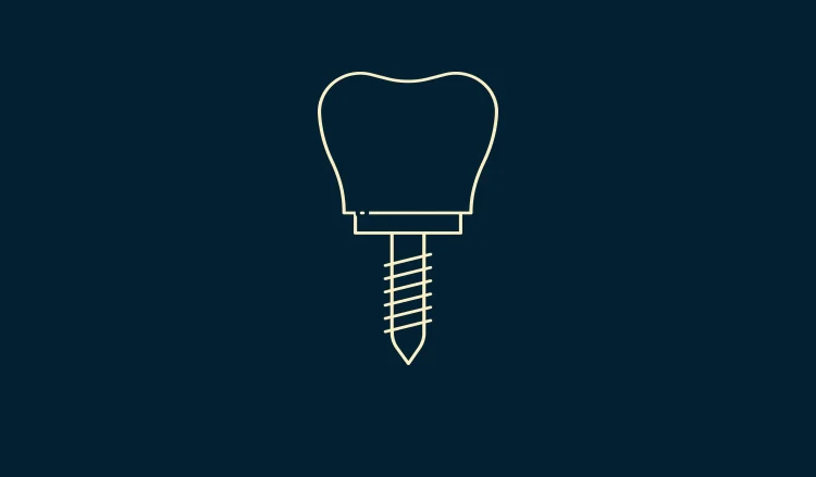 Implantologie, faq, GAD Cabinet dentaire à Bordeaux