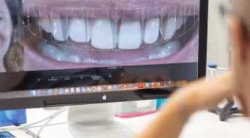 Analyse diagnostique d’un traitement esthétique : digital smile design