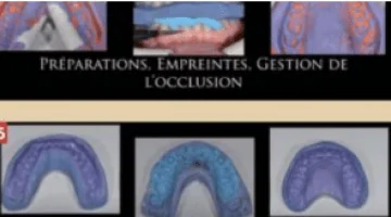 Analyse diagnostique d’un traitement esthétique : digital smile design au GAD Cabinet dentaire à Bordeaux (33000)