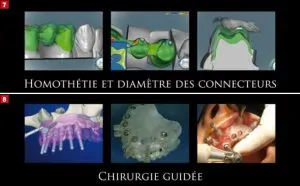 CFAO ET IMPLANTOLOGIE